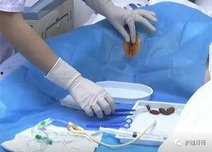 导尿操作视频,步骤与技巧全解析